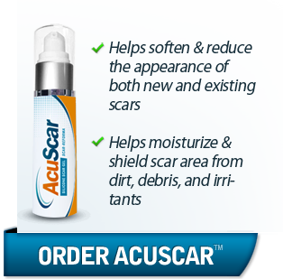 Order AcuScar